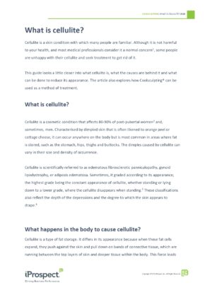 what is cellulite article